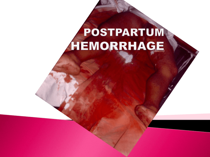 Ati real life postpartum hemorrhage